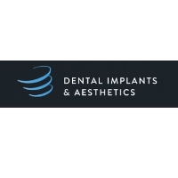 Dental Implants & Aesthetics