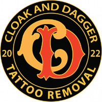 Cloak and Dagger Tattoo Removal