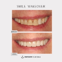 Brands,  Businesses, Places & Professionals Empower Your Smile DDS in New York NY