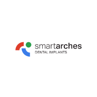 Smart Arches Dental Implants