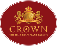 Crown Hair Transplant Experts