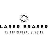 Brands,  Businesses, Places & Professionals Laser Eraser: Laser Tattoo Removal in Clark NJ