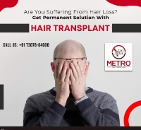 Brands,  Businesses, Places & Professionals Metro Hair Transplant Centre in Zirakpur PB