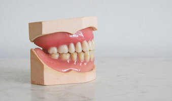 DENTAL CROWNS - BOYNTON BEACH, FL