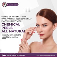 Dr Naiya Bansal - Chemical peel treatment in Chandigarh | 098880 01489