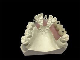 Dental Implant Manufacturer Ships Overseas