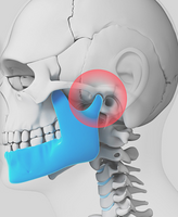 TMJ Treatment