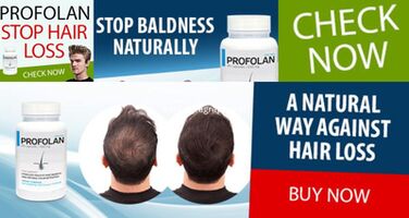 Profolan-Hair Loss