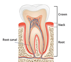 Root Canal Therapy in Brooklyn