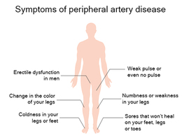 Peripheral Vascular Disease