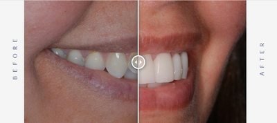 Cosmetic Dentistry