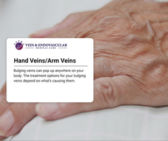 Hand Veins/Arm Veins