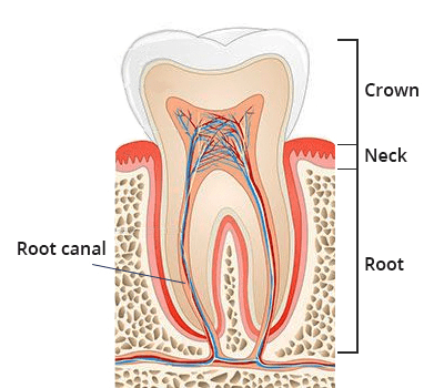 Root Canal Therapy in Brooklyn