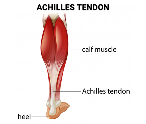Achilles Tendon Treatment