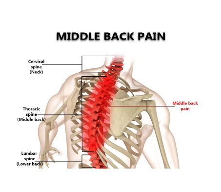 Mid Back Pain Treatment